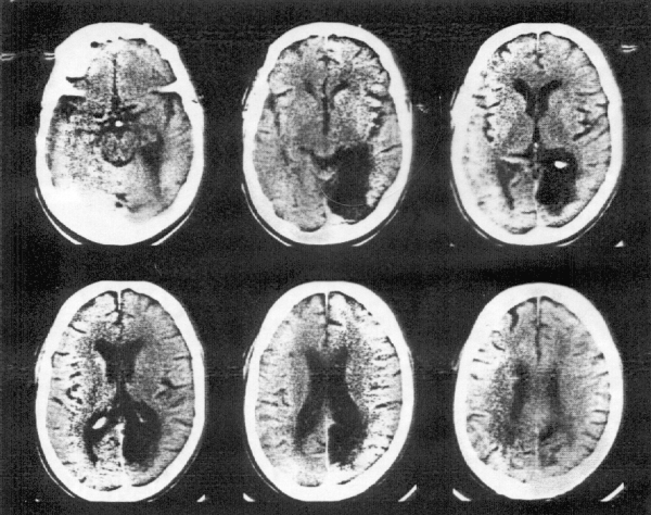 cat scans math central cat scan 600x474